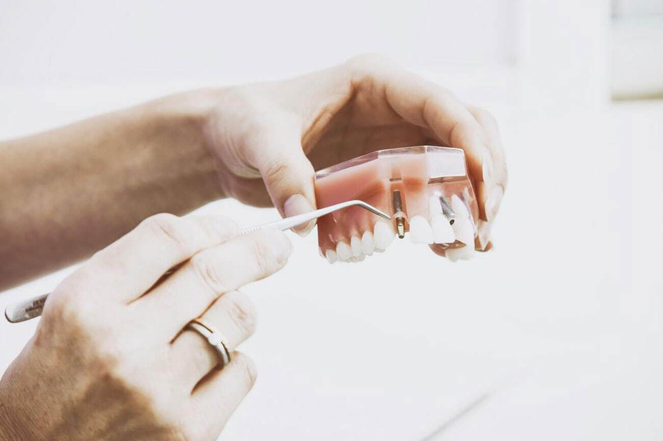 Pair of dentists’ hands holding false teeth with an implant